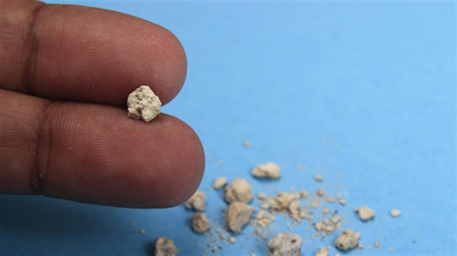 小心!維生素C過多會導致腎結石